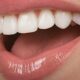 Sacramento Dentist: Less Recognized Causes of Teeth Discoloration