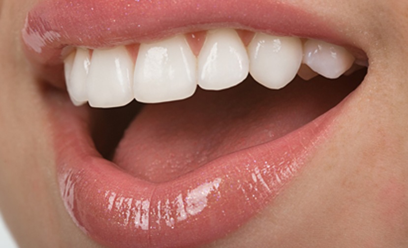Sacramento-Dentist-Less-Recognized-Causes-of-Teeth-Discoloration