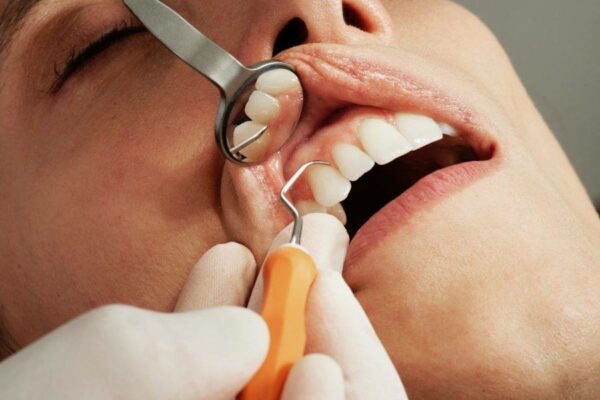 celebrity teeth whitening - Cosmetic dentist sacramento