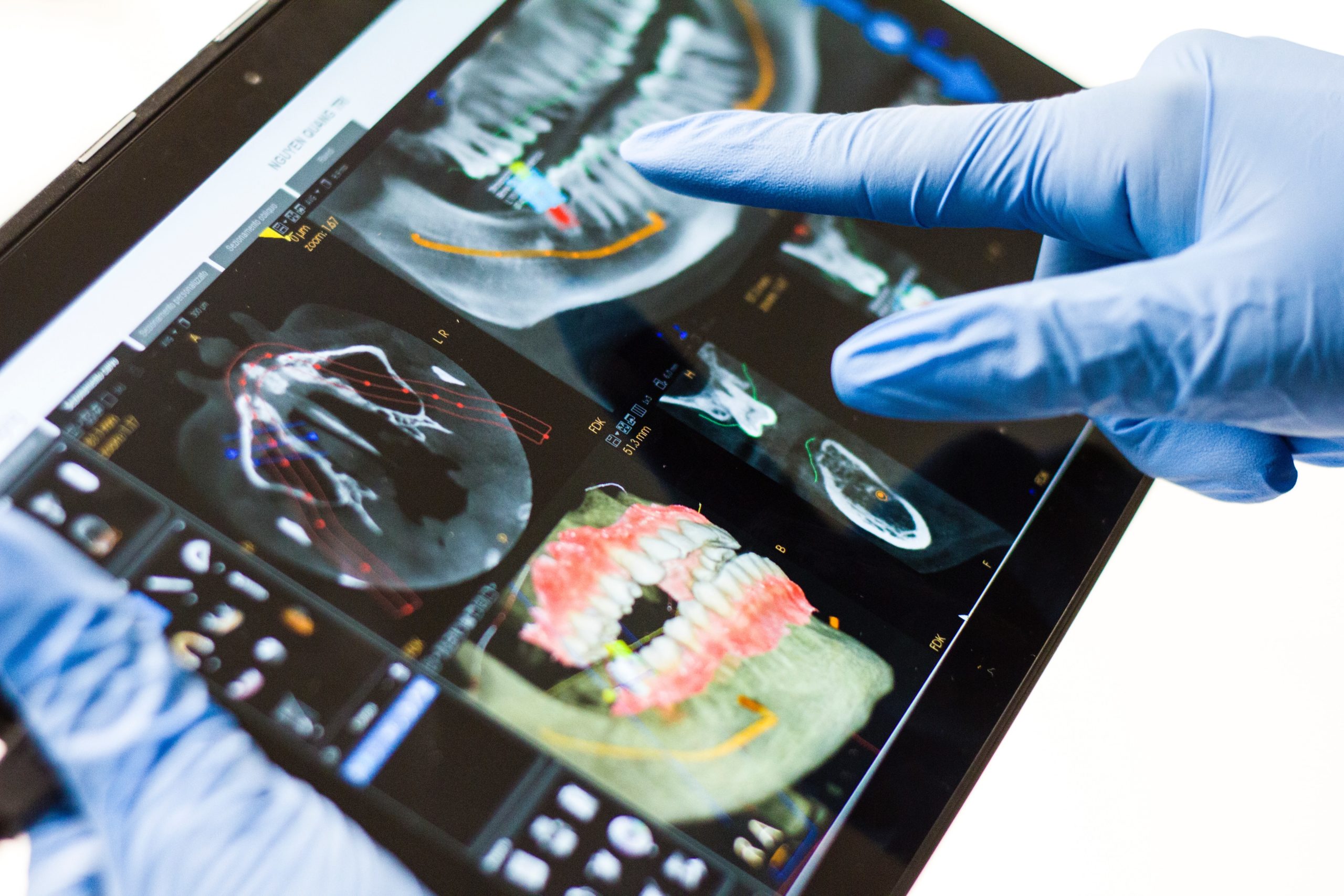 dental scans displayed on a tablet screen by dr monica crooks